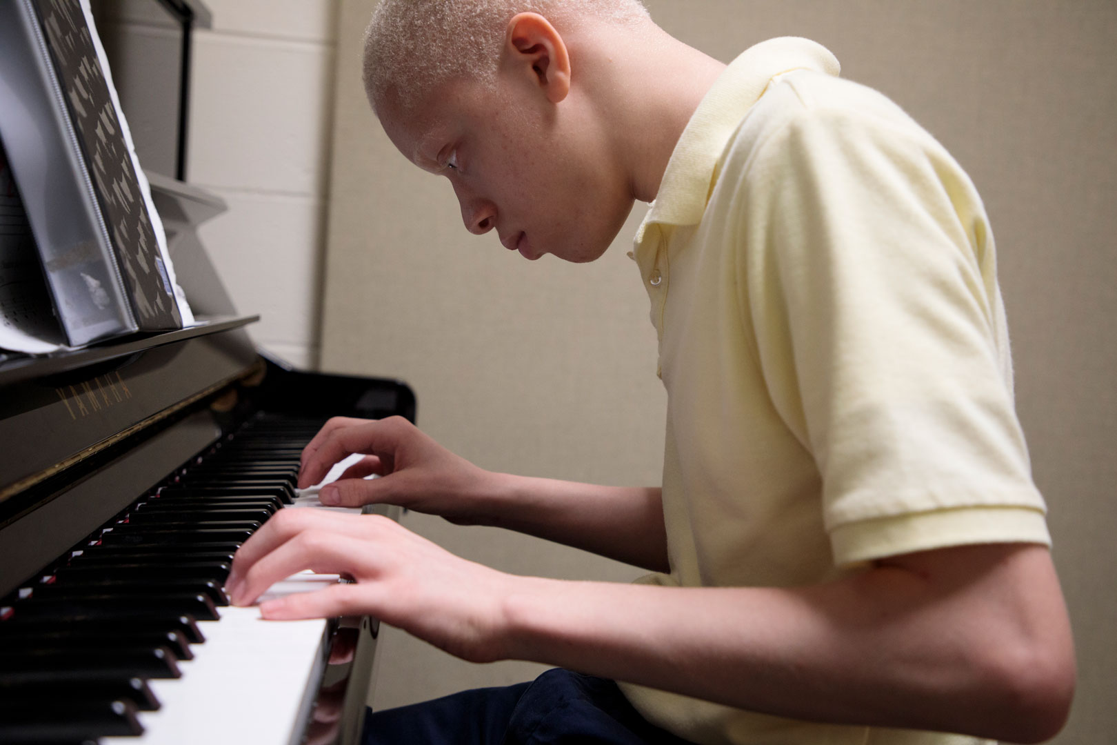 A teenage boy with albinism playing a piano.